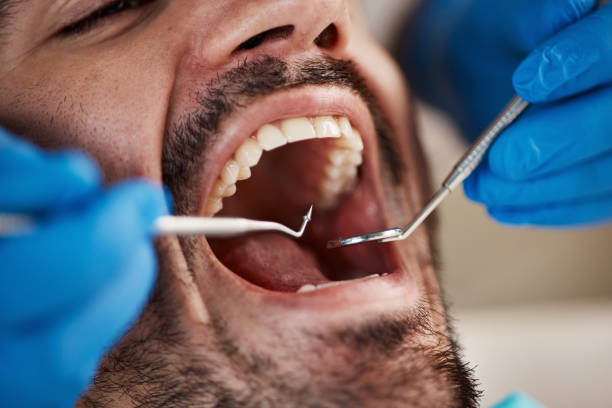 Best Emergency Dental Care for Sports Injuries in Enterprise, UT